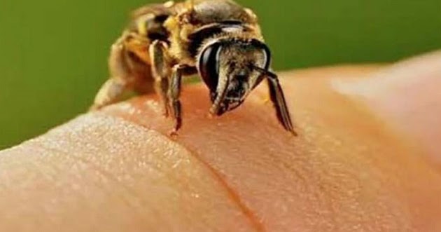 Οι κινήσεις που θα κάνεις αν σε τσιμπήσει μέλισσα ή σφήκα